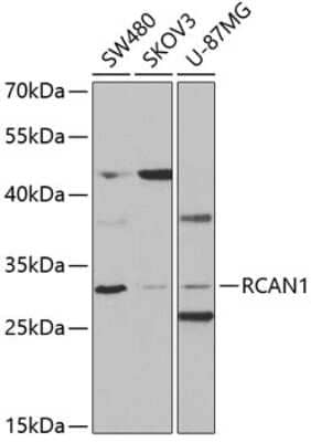 Western Blot: RCAN1 AntibodyBSA Free [NBP2-94137]