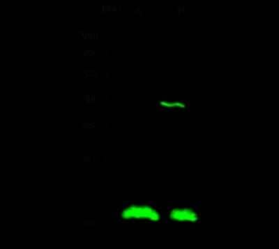 Western Blot: RCAN1 Antibody [NBP2-98713]