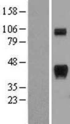 Western Blot: RCAN1 Overexpression Lysate [NBP2-04453]