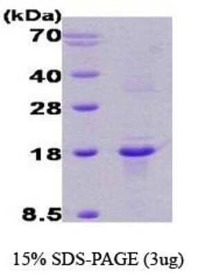 SDS-PAGE: Recombinant Human RCAN1 Protein [NBC1-18339]