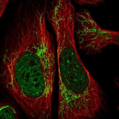 Immunocytochemistry/ Immunofluorescence: RCAN2 Antibody [NBP2-30409]