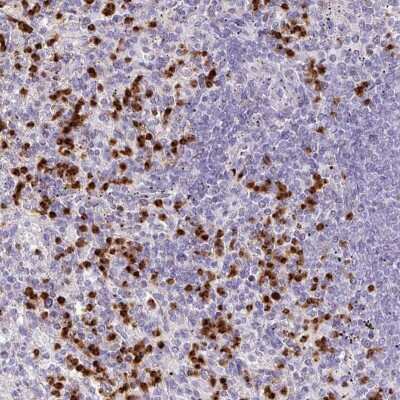 Immunohistochemistry-Paraffin: RCAN2 Antibody [NBP2-30409]