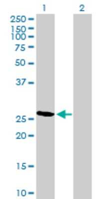 Western Blot: RCAN2 Antibody [H00010231-B01P]