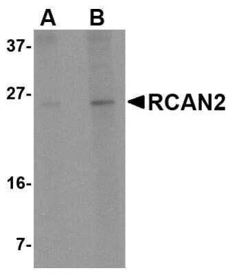 Western Blot: RCAN2 AntibodyBSA Free [NBP1-76995]