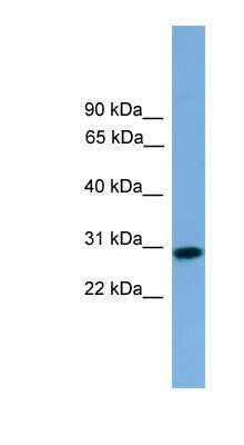 Western Blot: RCAN2 Antibody [NBP1-79477]