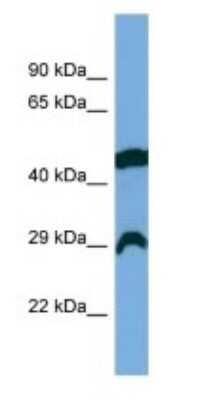 Western Blot: RCAN2 Antibody [NBP3-09305]