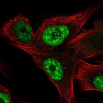 Immunocytochemistry/ Immunofluorescence: RCAN3 Antibody [NBP2-57619]