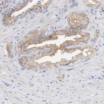 Immunohistochemistry-Paraffin: RCAN3 Antibody [NBP1-84972]