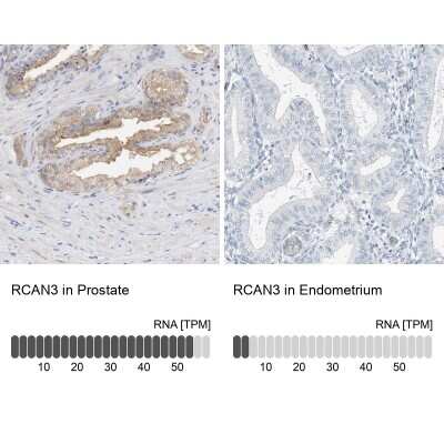 Immunohistochemistry-Paraffin: RCAN3 Antibody [NBP1-84972]