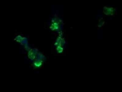 Immunocytochemistry/ Immunofluorescence: RCAN3 Antibody (OTI1B2) - Azide and BSA Free [NBP2-73842]