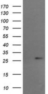 Western Blot: RCAN3 Antibody (OTI1B2)Azide and BSA Free [NBP2-73842]