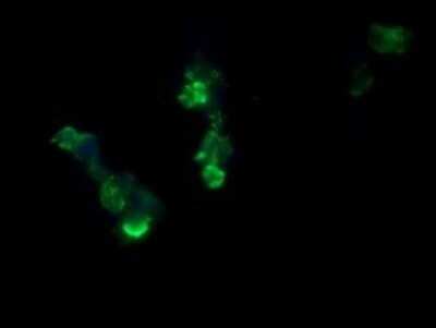 Immunofluorescence: RCAN3 Antibody (OTI1B2) [NBP2-45928]