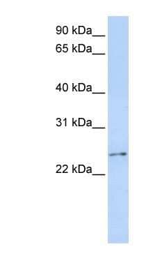 Western Blot: RCAN3 Antibody [NBP1-58949]