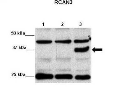 Western Blot: RCAN3 Antibody [NBP1-58949]