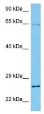 Western Blot: RCAN3 Antibody [NBP3-10077]