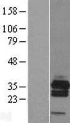 Western Blot: RCAN3 Overexpression Lysate [NBL1-15240]