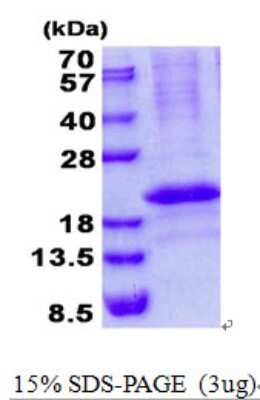 SDS-PAGE: Recombinant Human RCAN3 His Protein [NBP2-23401]