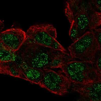 Immunocytochemistry/ Immunofluorescence: RCBTB1 Antibody [NBP2-58358]