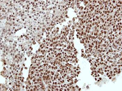 Immunohistochemistry-Paraffin: RCBTB1 Antibody [NBP2-20116]
