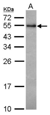 Western Blot: RCBTB1 Antibody [NBP2-20116]