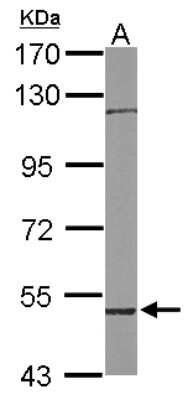 Western Blot: RCBTB1 Antibody [NBP2-20116]