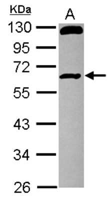 Western Blot: RCBTB1 Antibody [NBP2-20117]