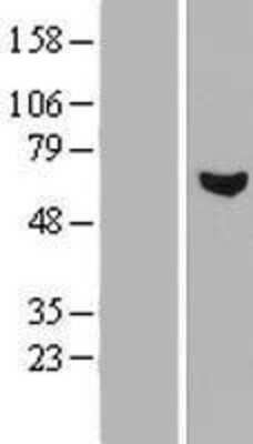 Western Blot: RCBTB1 Overexpression Lysate [NBP2-06855]