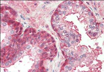 Immunohistochemistry-Paraffin: RCBTB2 Antibody [NBP1-36981]