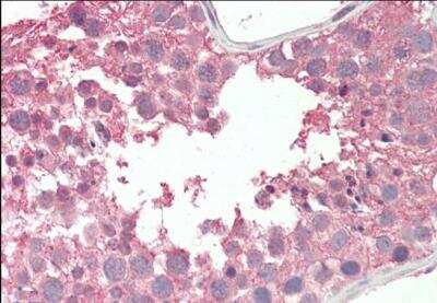 Immunohistochemistry-Paraffin: RCBTB2 Antibody [NBP1-36981]