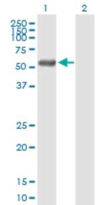 Western Blot: RCBTB2 Antibody [H00001102-B01P]