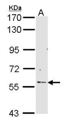 Western Blot: RCBTB2 Antibody [NBP1-33512]