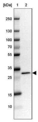 Western Blot: RCBTB2 Antibody [NBP1-85636]