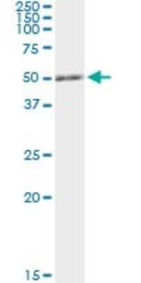 Immunoprecipitation: RCC1 Antibody (1C1) [H00001104-M02]