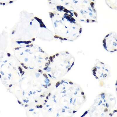 Immunohistochemistry-Paraffin: RCC1 Antibody (1F0C5) [NBP3-15295]