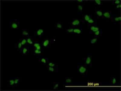 Immunocytochemistry/ Immunofluorescence: RCC1 Antibody (2F1) [H00001104-M01]