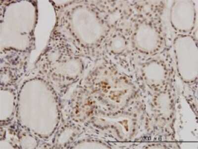 Immunohistochemistry-Paraffin: RCC1 Antibody (2F1) [H00001104-M01]