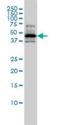 Western Blot: RCC1 Antibody (2F1) [H00001104-M01]