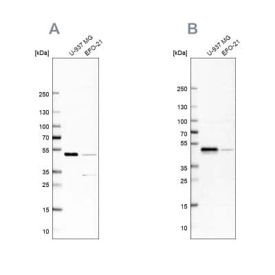 Western Blot: RCC1 Antibody [NBP1-85637]