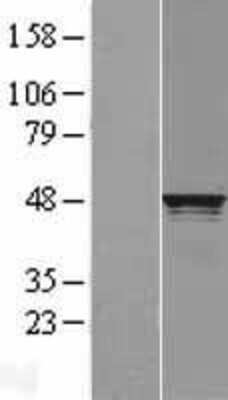 Western Blot: RCC1 Overexpression Lysate [NBL1-15242]