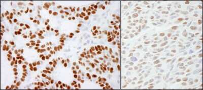 Immunohistochemistry-Paraffin: RCC2 Antibody [NB110-40619]
