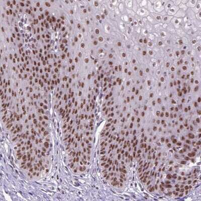 Immunohistochemistry: RCC2 Antibody [NBP2-49676]