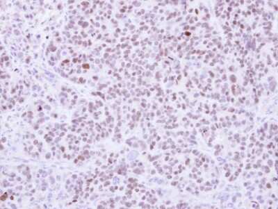 Immunohistochemistry-Paraffin: RCC2 Antibody [NBP1-32602]