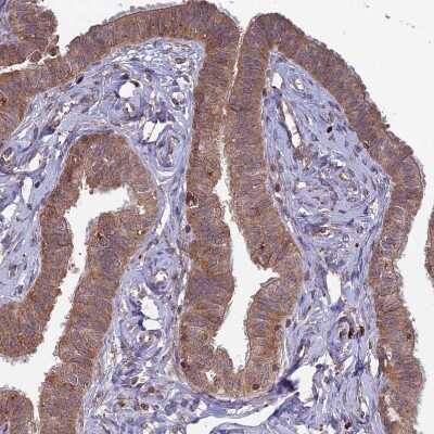 Immunohistochemistry-Paraffin: RCCD1 Antibody [NBP1-93517]