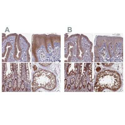 Immunohistochemistry-Paraffin: RCCD1 Antibody [NBP1-93517]