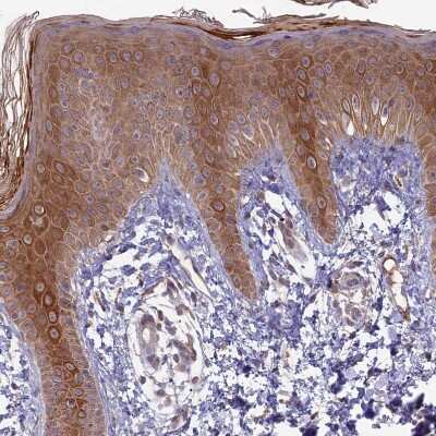 Immunohistochemistry-Paraffin: RCCD1 Antibody [NBP1-93517]