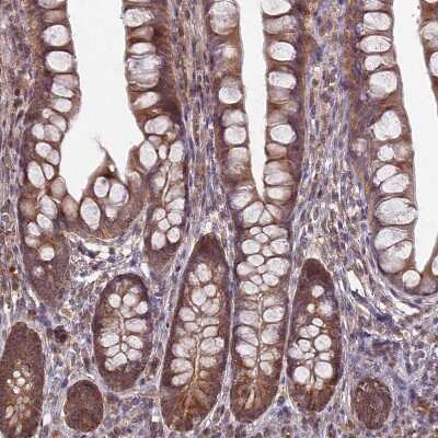 Immunohistochemistry-Paraffin: RCCD1 Antibody [NBP1-93517]
