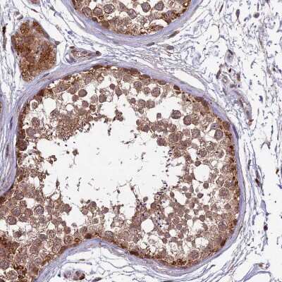 Immunohistochemistry-Paraffin: RCCD1 Antibody [NBP1-93517]