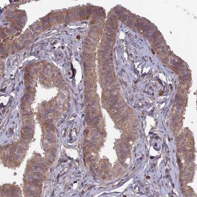Immunohistochemistry-Paraffin: RCCD1 Antibody [NBP1-93518]