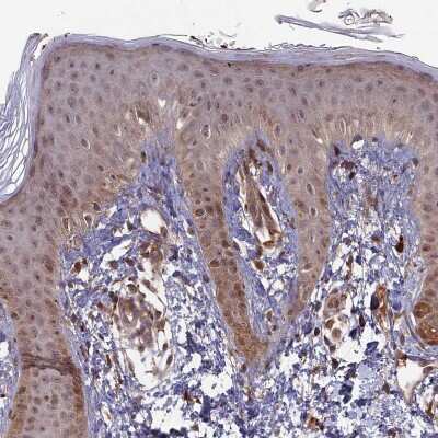 Immunohistochemistry-Paraffin: RCCD1 Antibody [NBP1-93518]