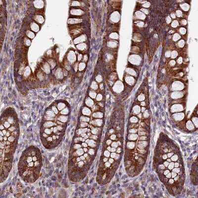 Immunohistochemistry-Paraffin: RCCD1 Antibody [NBP1-93518]